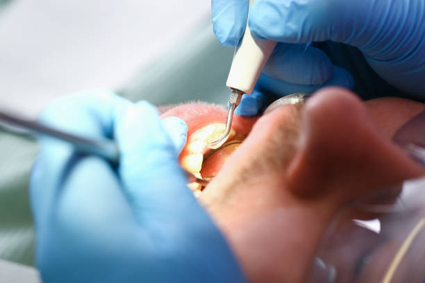 Best Urgent Dental Care for Toothache in New Madrid, MO