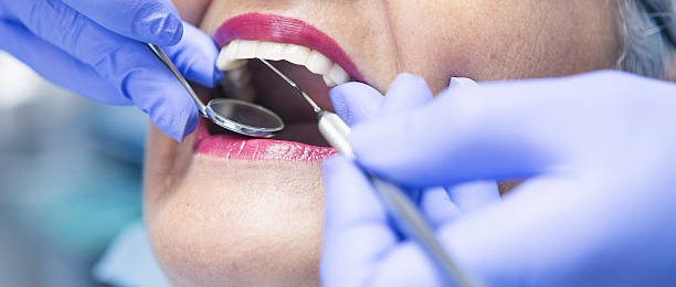 Best Emergency Dental Care for Abscessed Tooth in New Madrid, MO